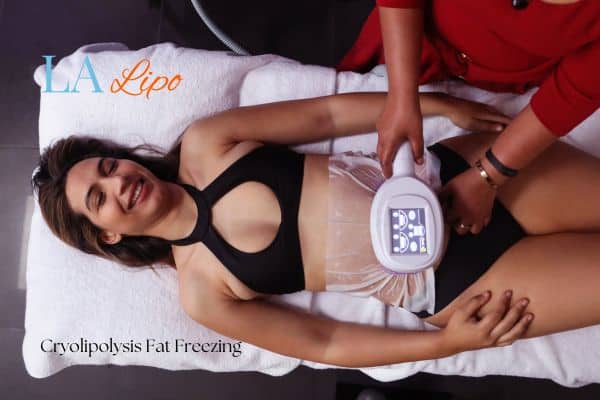 woman getting cryolipolysis Belsize Park