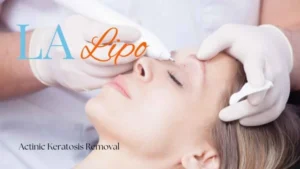Woman receiving Actinic Keratosis Removal Treatment Belsize Park
