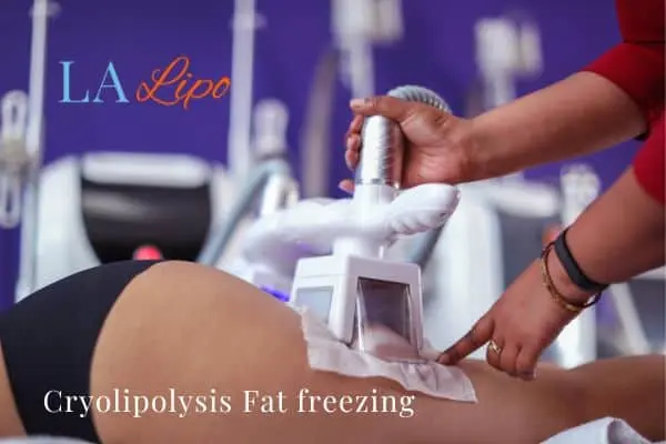 women getting fat freezing Belsize Park