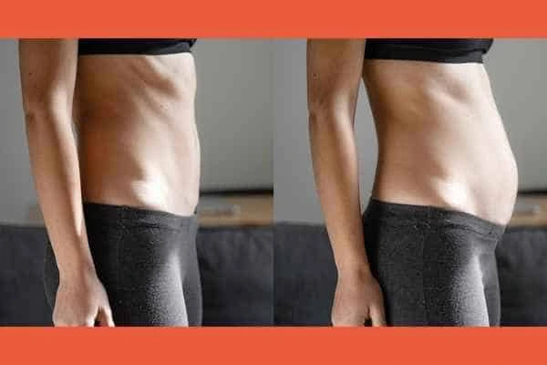 LA-EMS Body Sculpting results Belsize Park