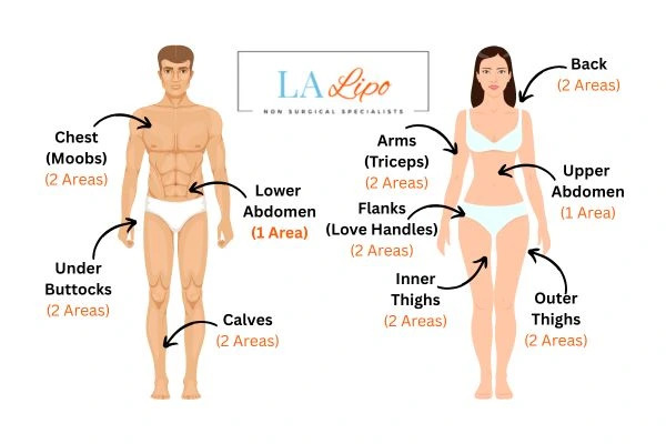 LA LIPO Cryolipolysis Areas Belsize Park