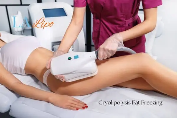 Woman receiving coolsculpting Belsize Park treatment on her thighs