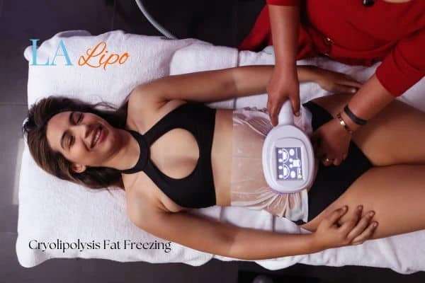 woman getting cryolipolysis Belsize Park