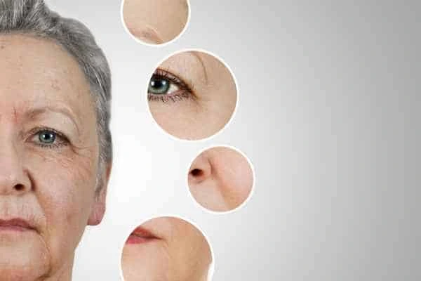 HIFU Facelift Belsize Park from LA LIPO