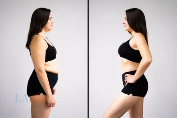 link between body image and mental health Belsize Park