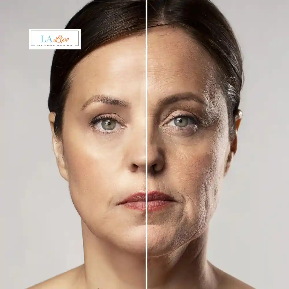 How Can You Tell If Non-Surgical Skin Tightening Is Right for You Belsize Park?