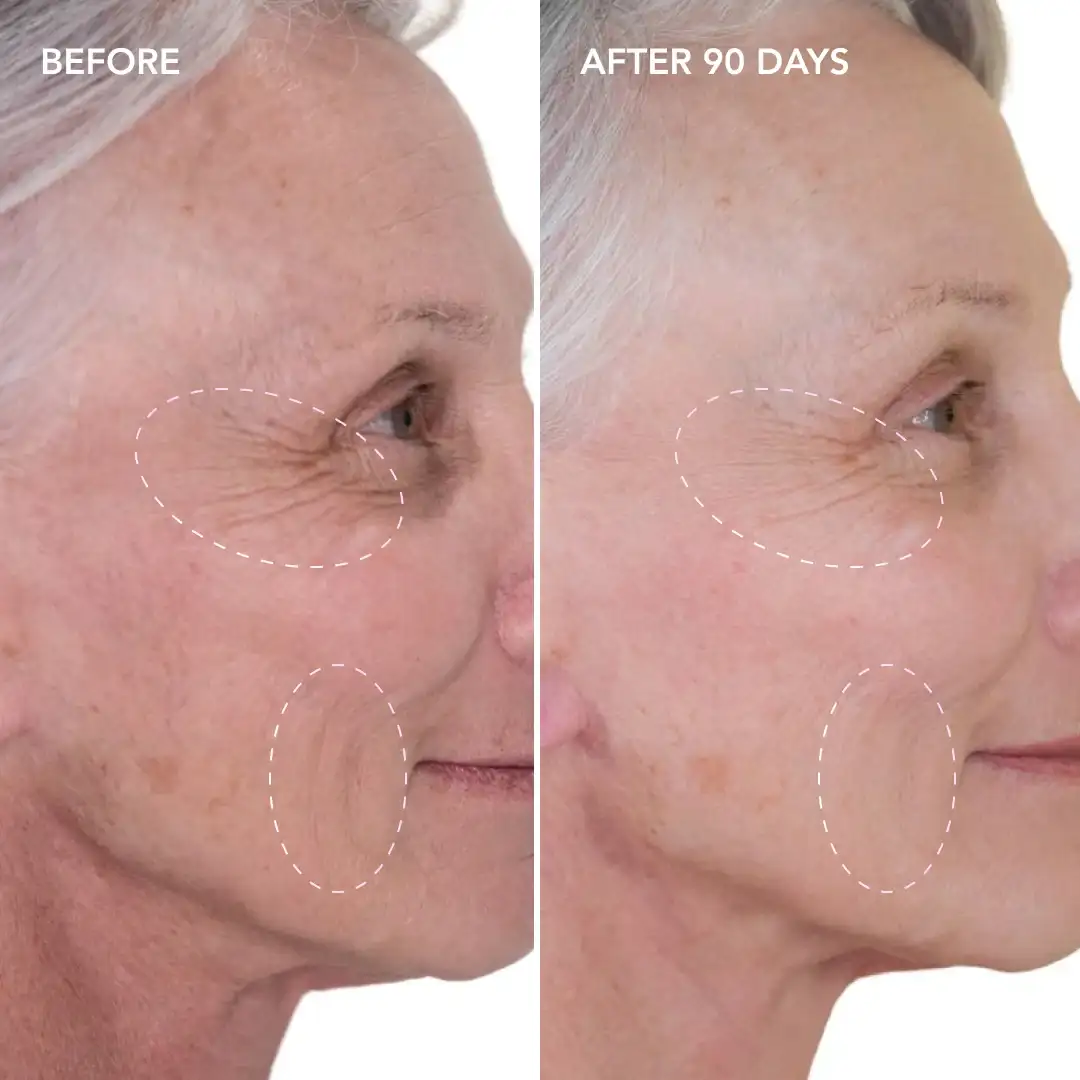 When will you see results Belsize Park
